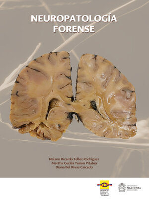 cover image of Neuropatología forense